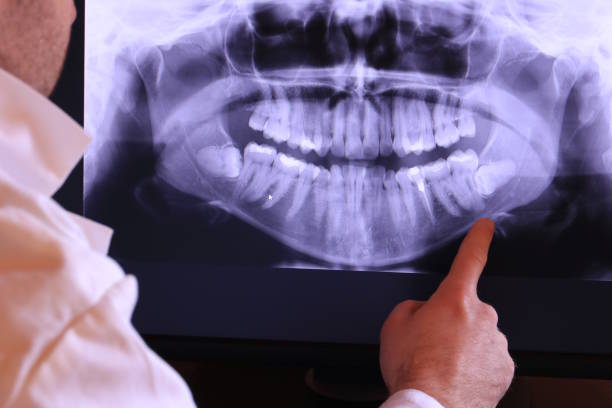 Best Broken or Chipped Tooth Repair in Weston, WI